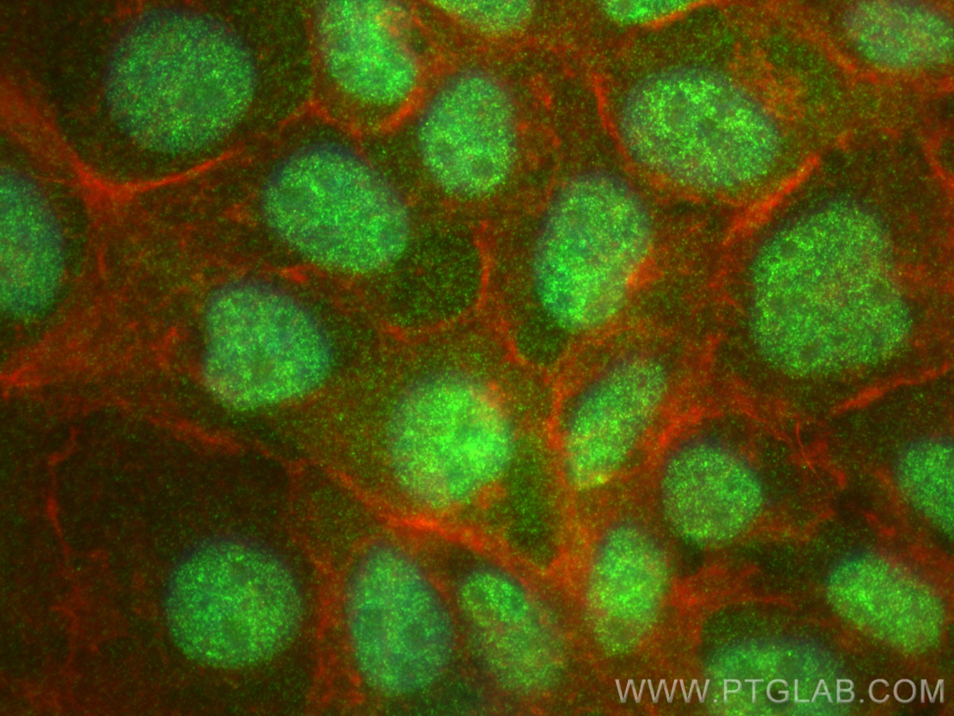 IF Staining of A431 using 83479-4-RR