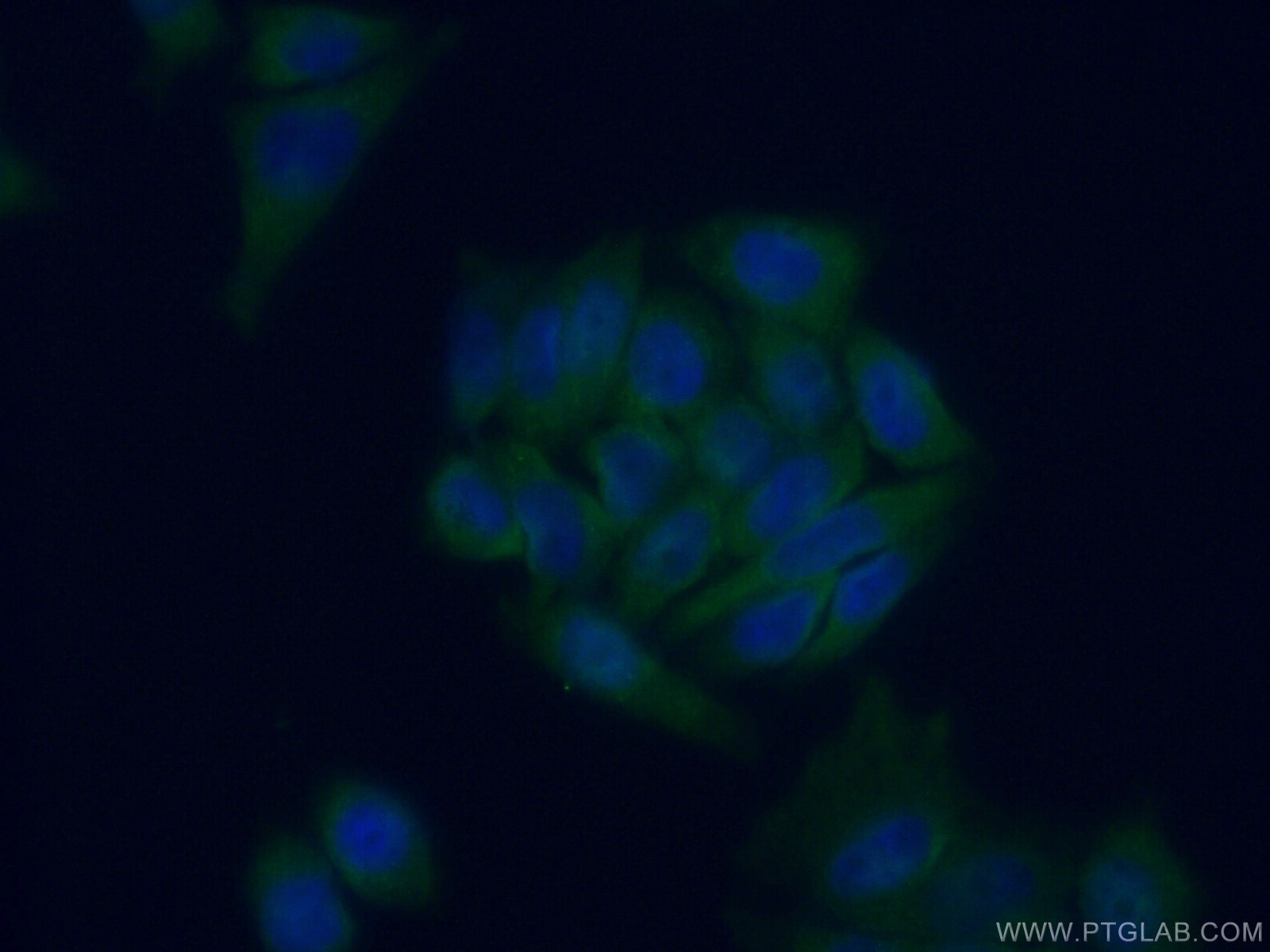 IF Staining of HeLa using 12607-1-AP