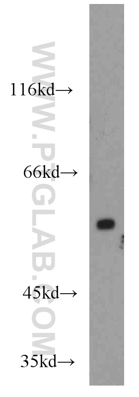 WB analysis of mouse brain using 12607-1-AP