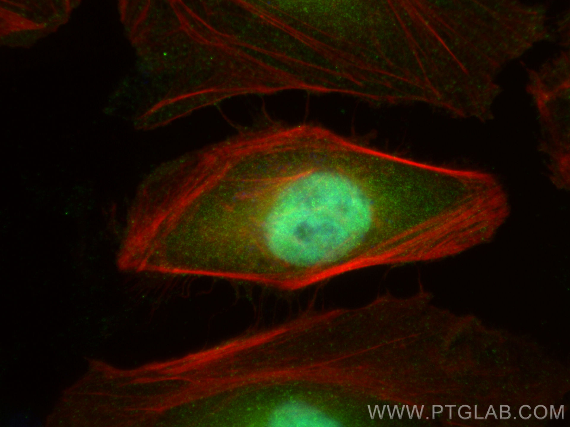 IF Staining of HeLa using 14208-1-AP