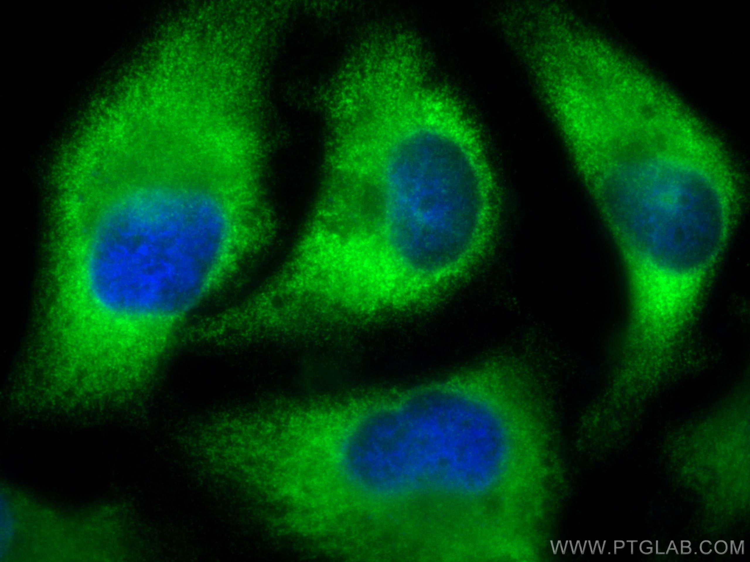 IF Staining of HeLa using 12573-1-AP