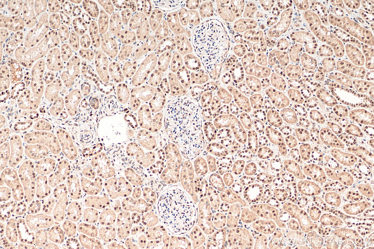 IHC staining of human kidney using 12573-1-AP