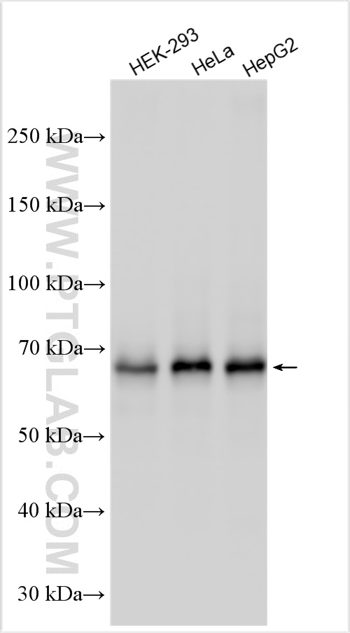 WB analysis using 12573-1-AP