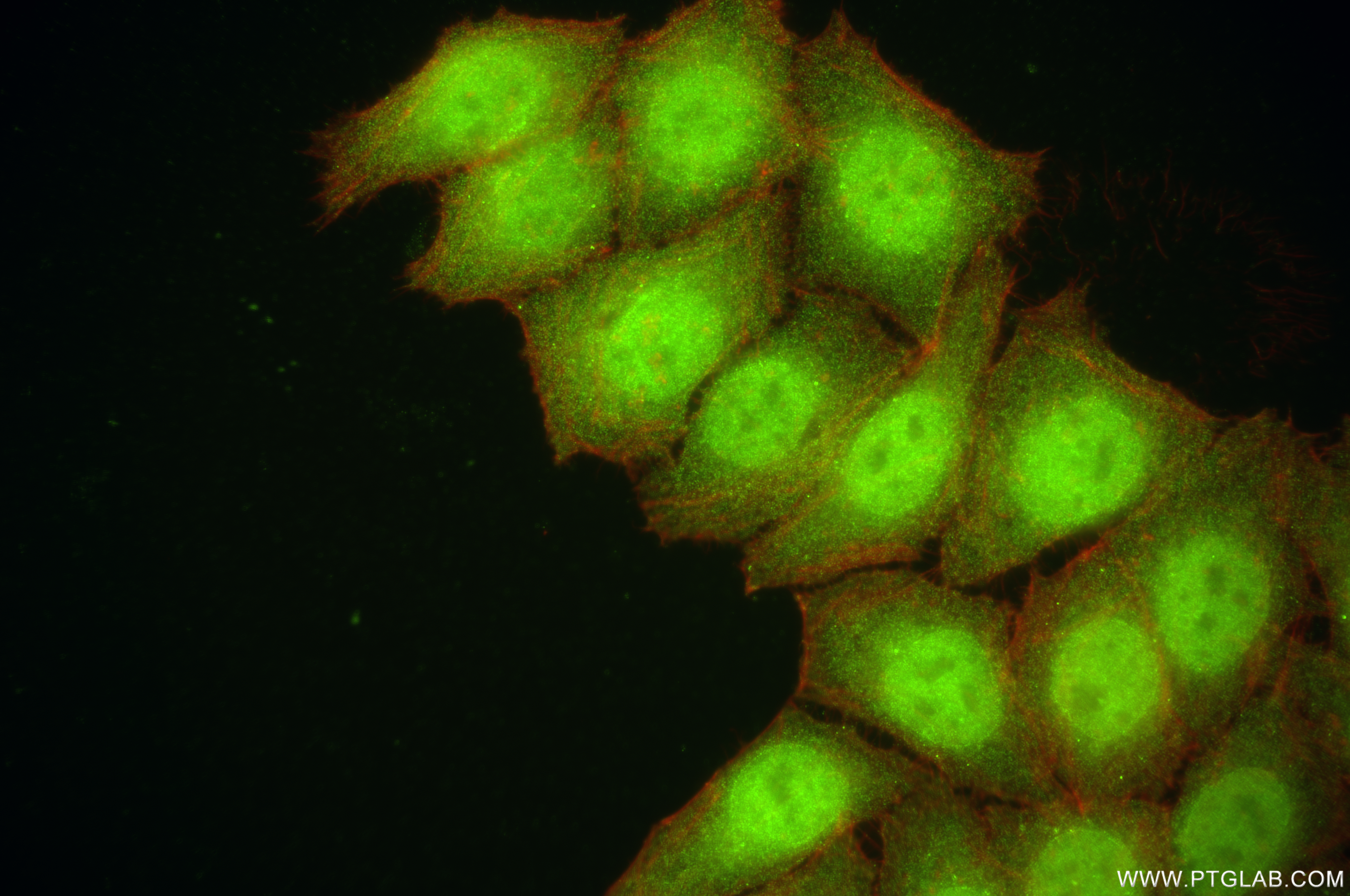 IF Staining of HepG2 using 84927-6-RR