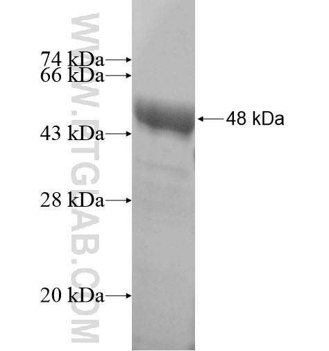 TRIM29 fusion protein Ag10611 SDS-PAGE