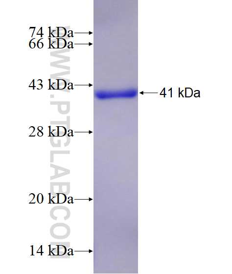 TRIM3 fusion protein Ag28823 SDS-PAGE