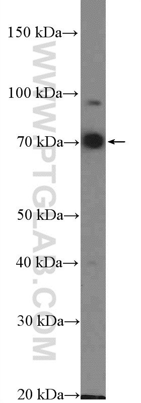 WB analysis of HEK-293 using 10326-1-AP