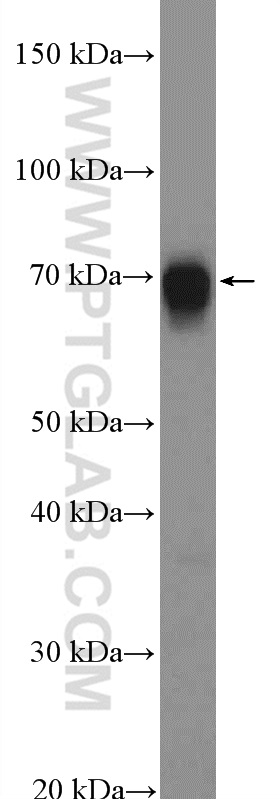 WB analysis of mouse colon using 10326-1-AP