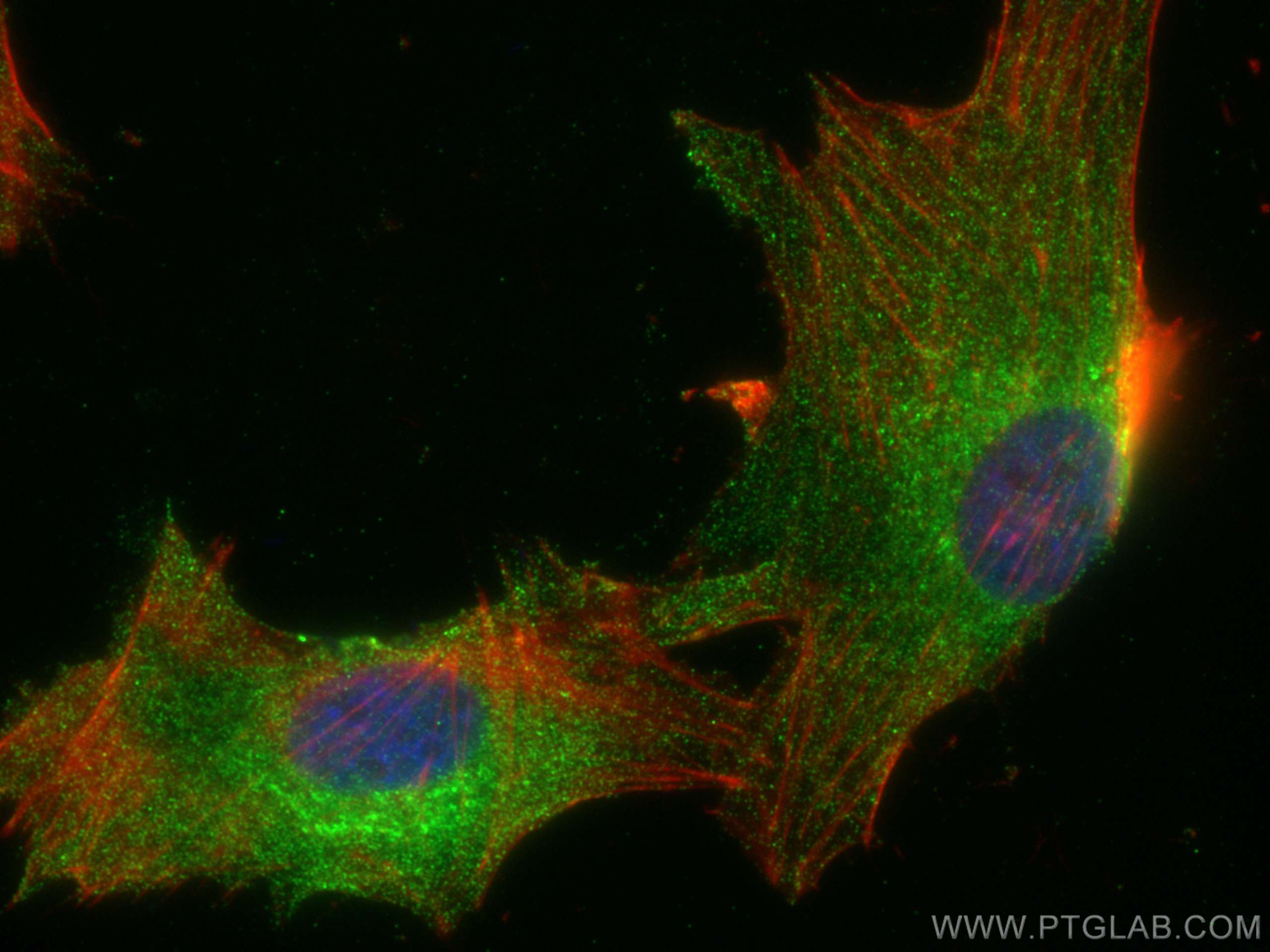 IF Staining of U-87 MG using 13037-1-AP