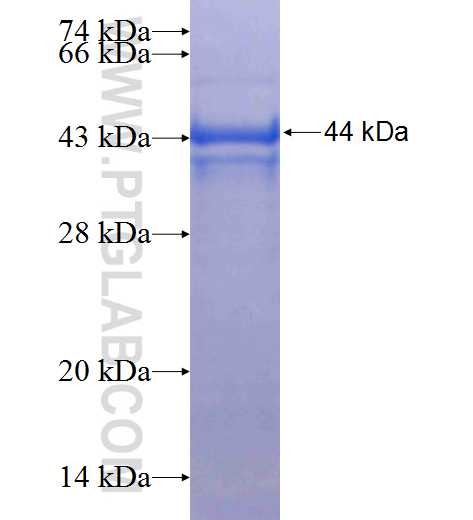 TRIM38 fusion protein Ag25204 SDS-PAGE