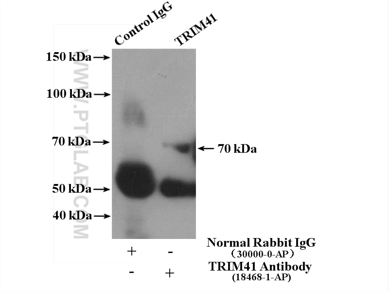 IP experiment of human plasma using 18468-1-AP