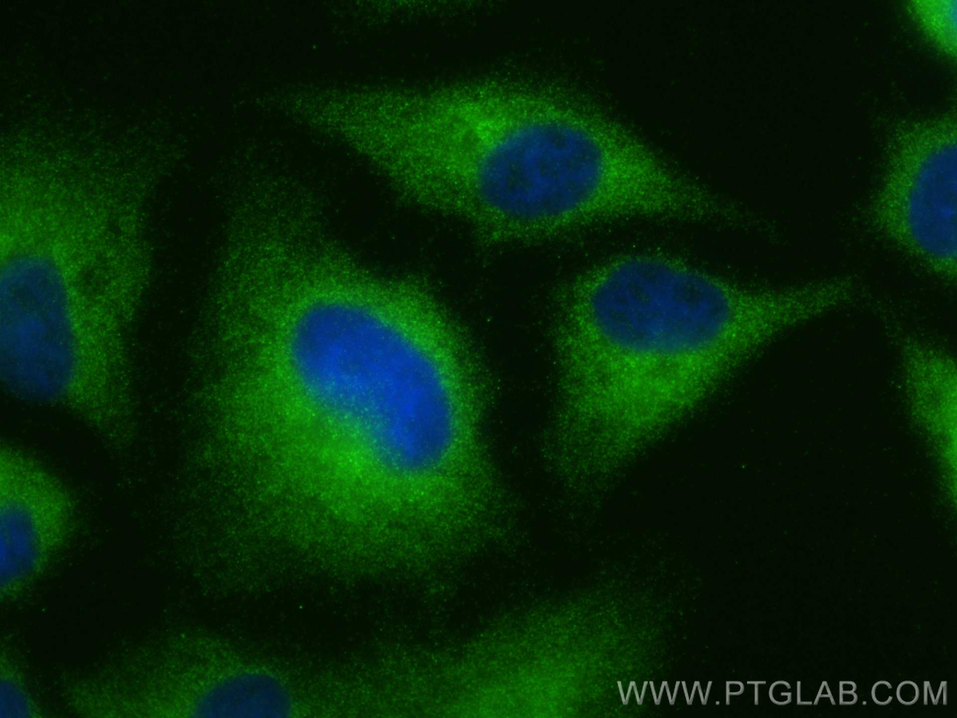 IF Staining of A549 using 21026-1-AP