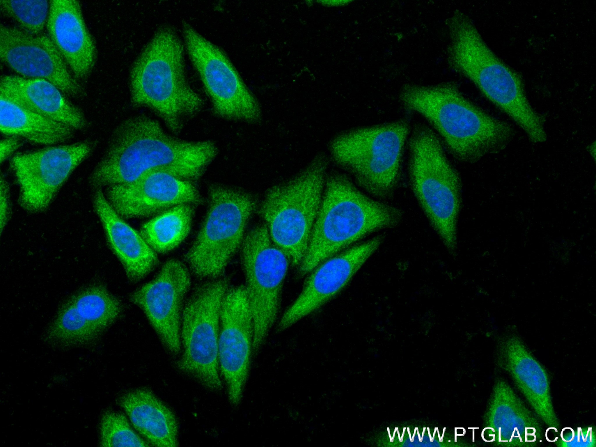 IF Staining of HepG2 using 83614-5-RR