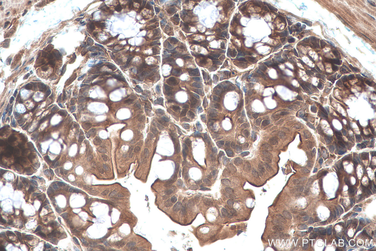 IHC staining of mouse colon using 26885-1-AP