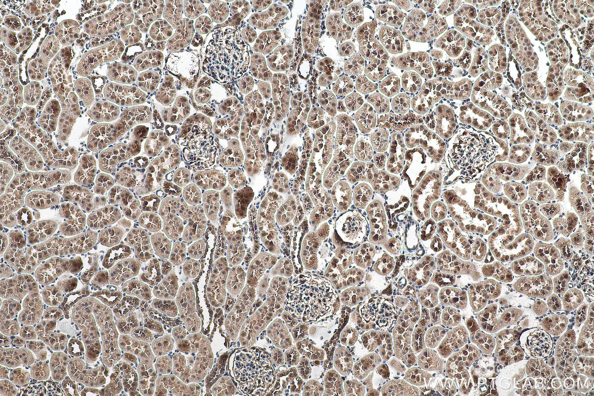 IHC staining of rat kidney using 26885-1-AP