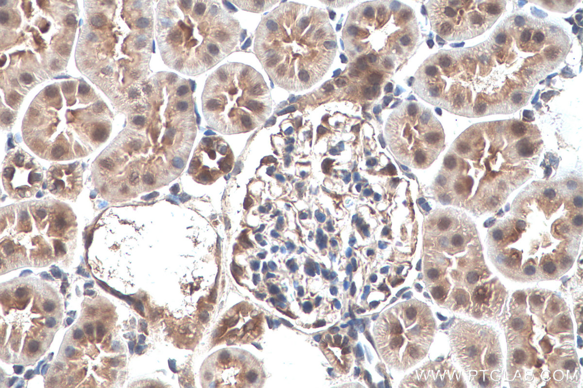 IHC staining of rat kidney using 26885-1-AP