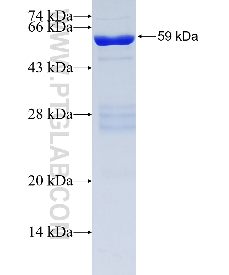 TRIM6 fusion protein Ag2556 SDS-PAGE