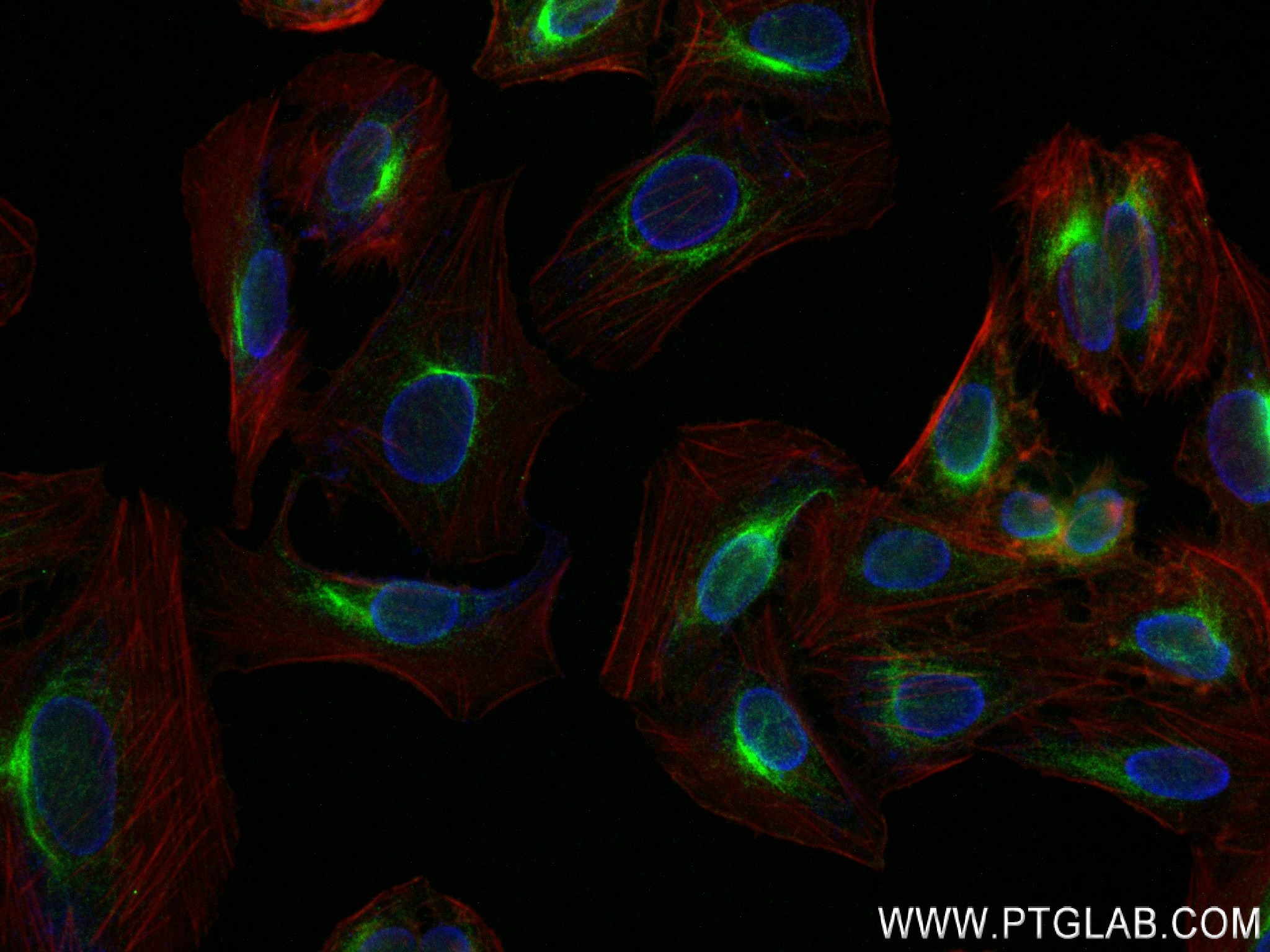 IF Staining of U2OS using 82892-1-RR (same clone as 82892-1-PBS)