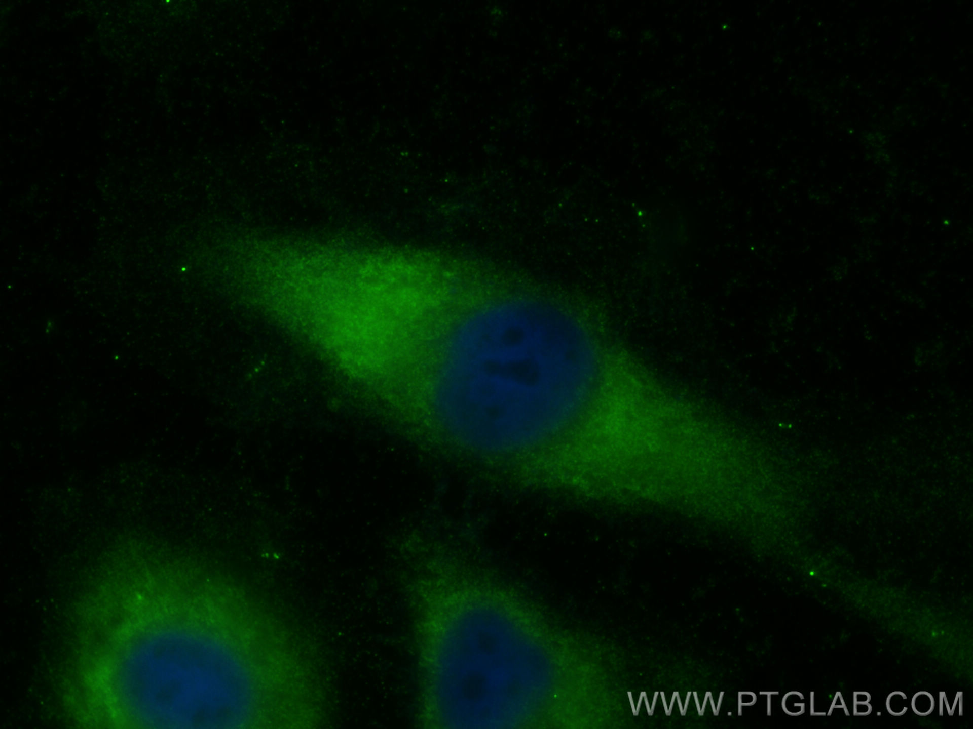 IF Staining of HeLa using 55456-1-AP