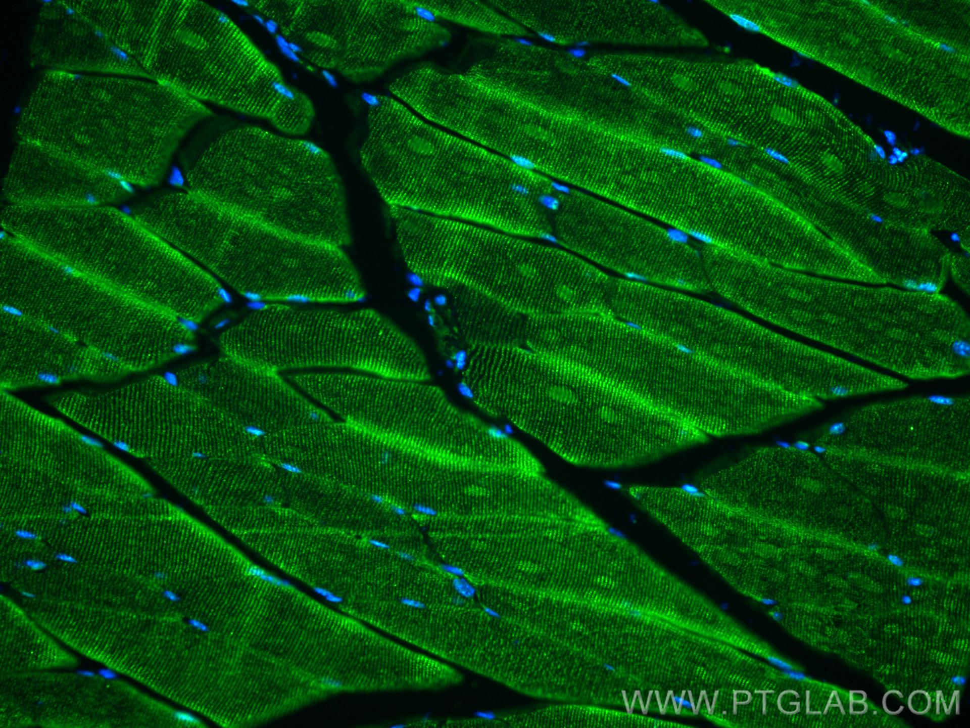 IF Staining of mouse skeletal muscle using 55456-1-AP