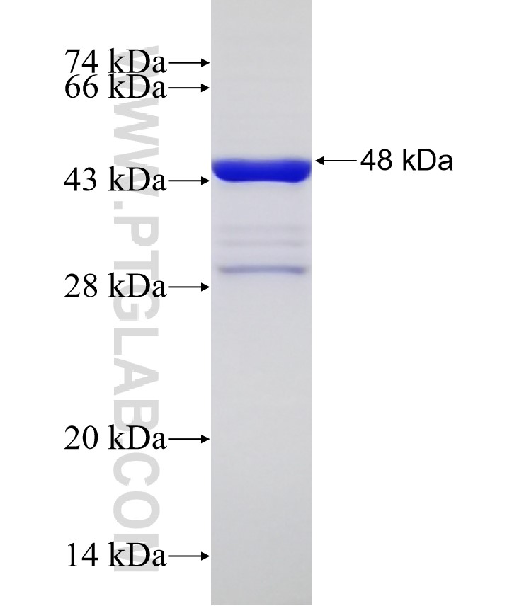 TRIM69 fusion protein Ag31775 SDS-PAGE