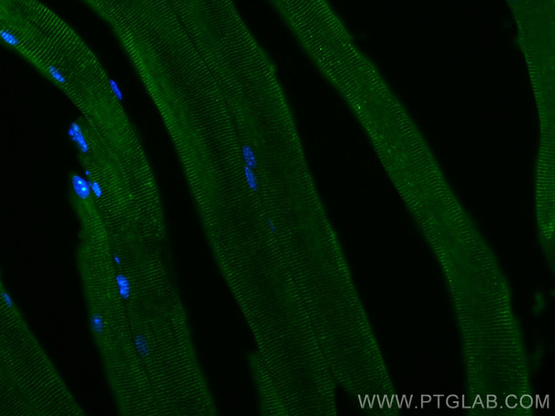 IF Staining of mouse skeletal muscle using 67403-1-Ig (same clone as 67403-1-PBS)