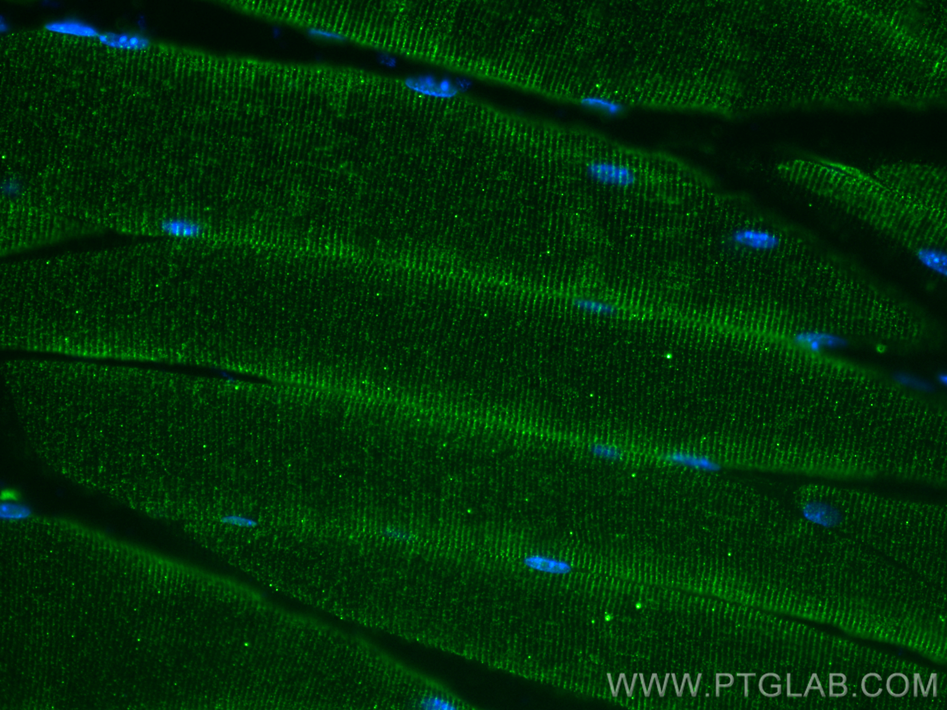 IF Staining of mouse skeletal muscle using 67403-1-Ig (same clone as 67403-1-PBS)