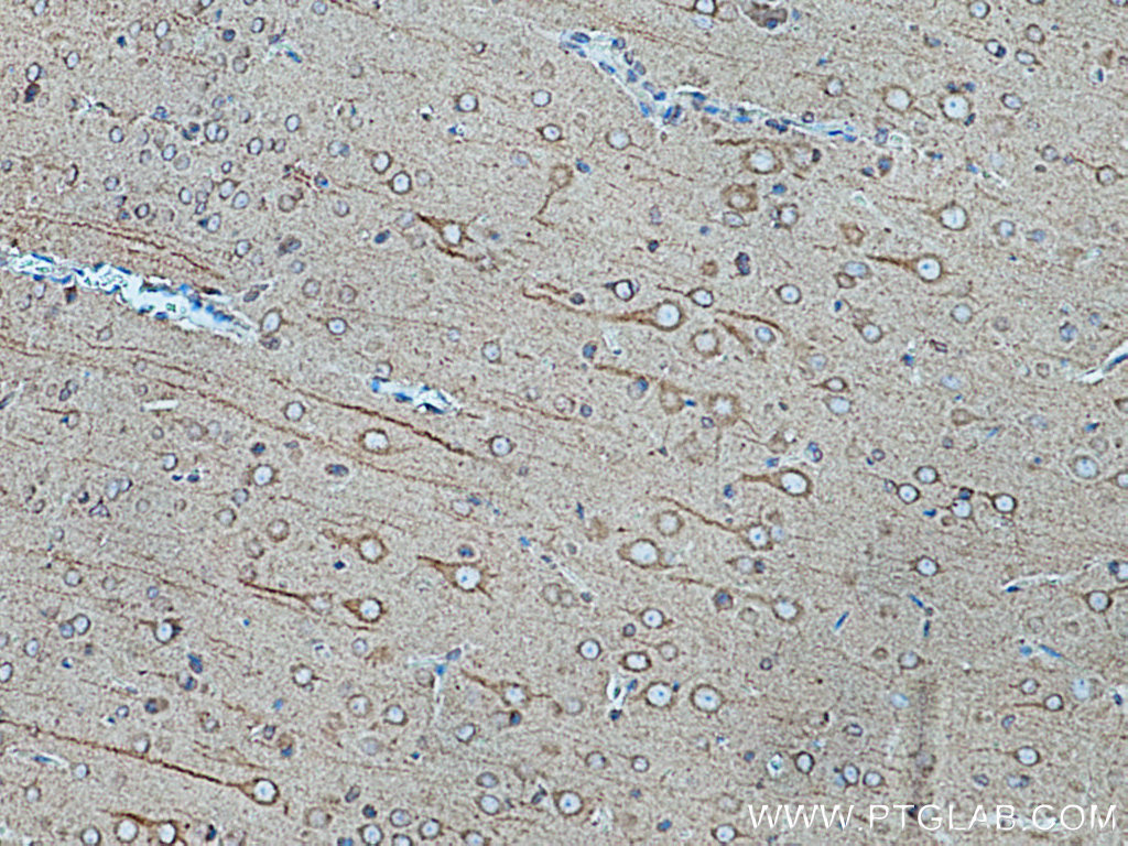 IHC staining of rat brain using 67268-1-Ig (same clone as 67268-1-PBS)