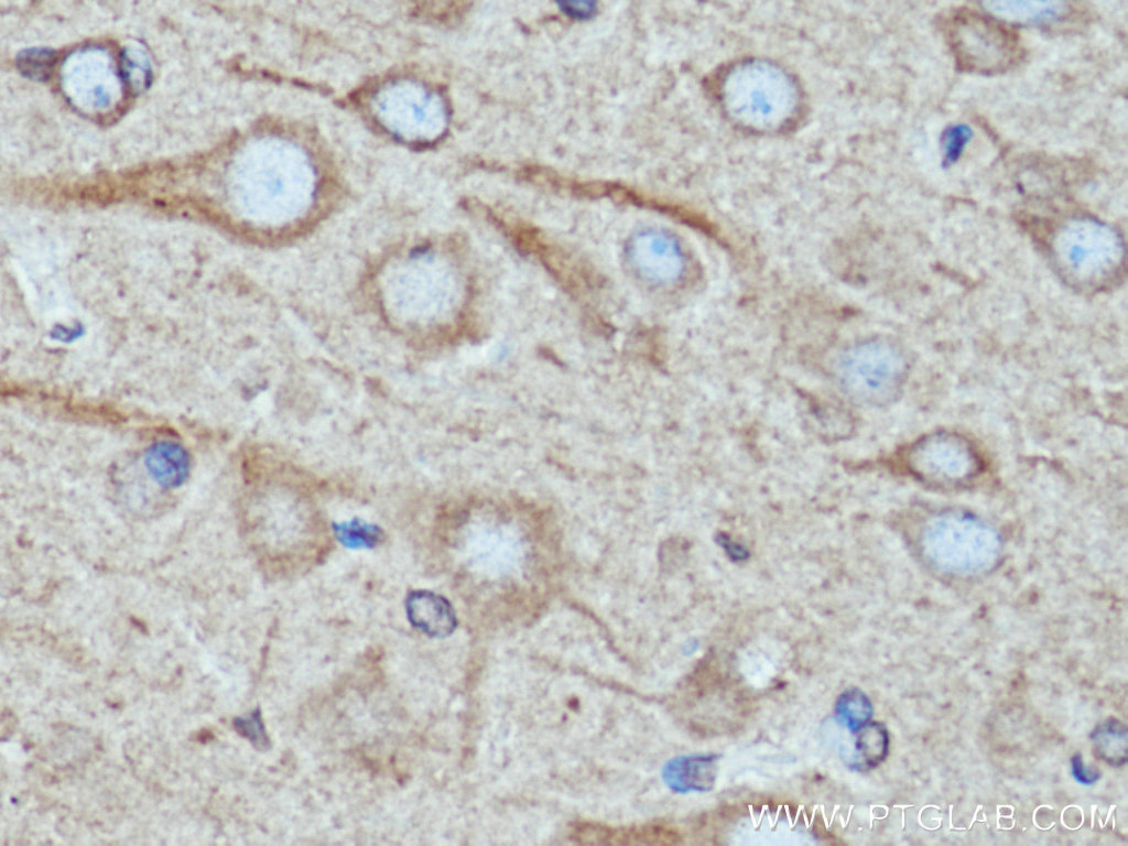 IHC staining of rat brain using 67268-1-Ig (same clone as 67268-1-PBS)