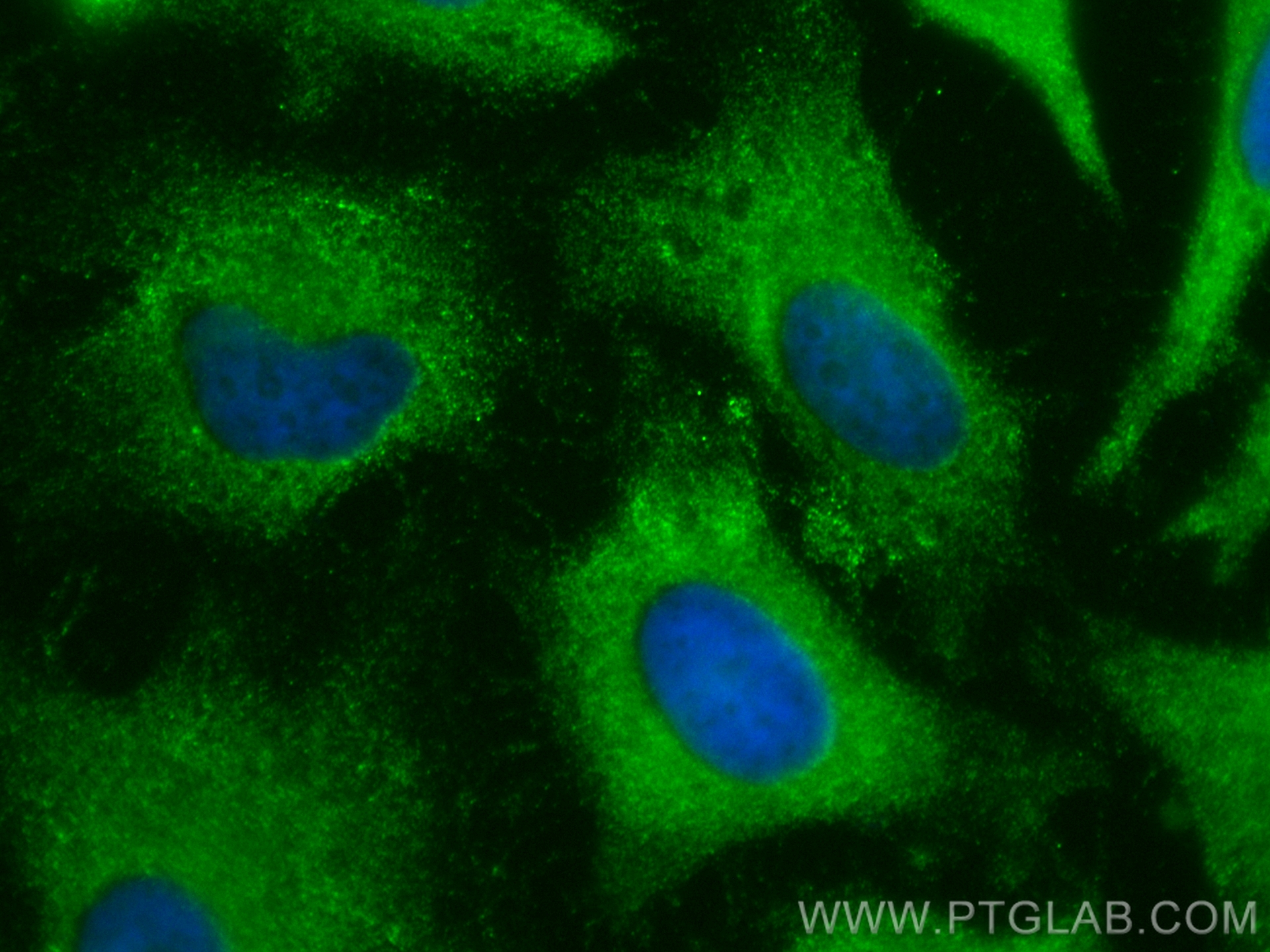 IF Staining of HeLa using CL488-10798