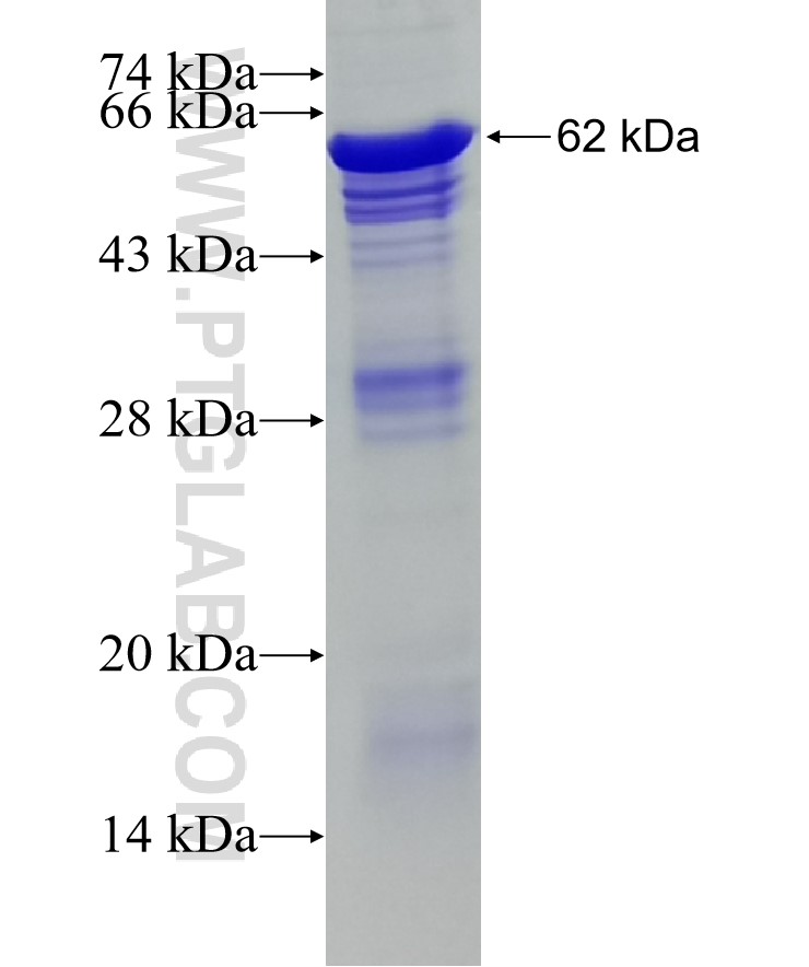 TRIP13 fusion protein Ag6508 SDS-PAGE