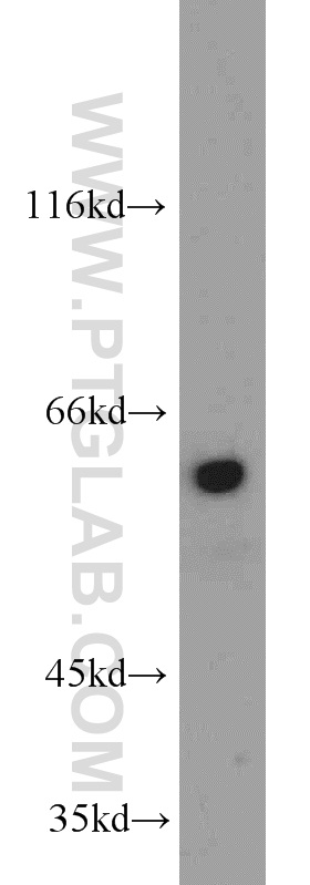 WB analysis of HL-60 using 12324-1-AP