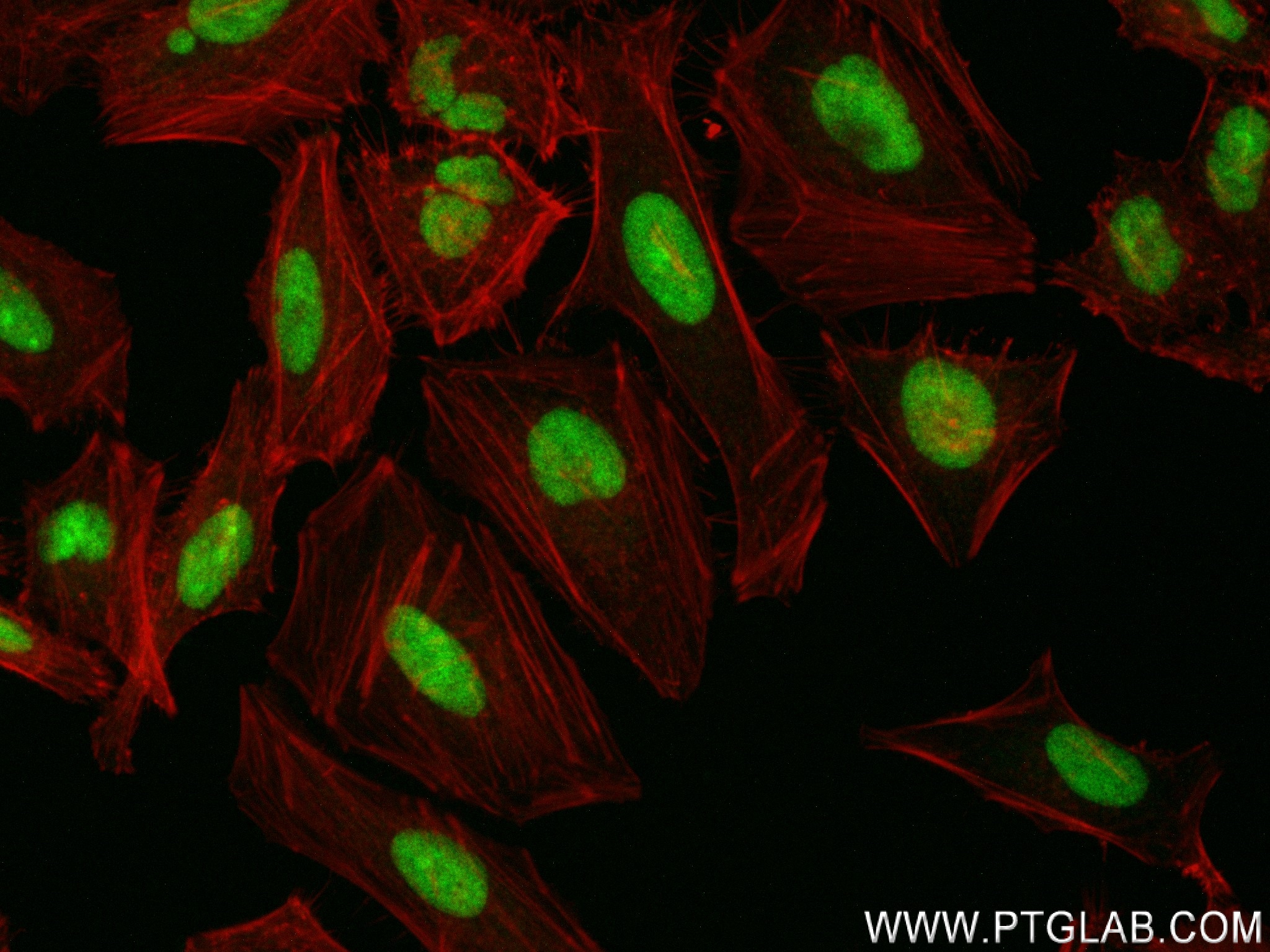 IF Staining of HeLa using 83843-5-RR (same clone as 83843-5-PBS)