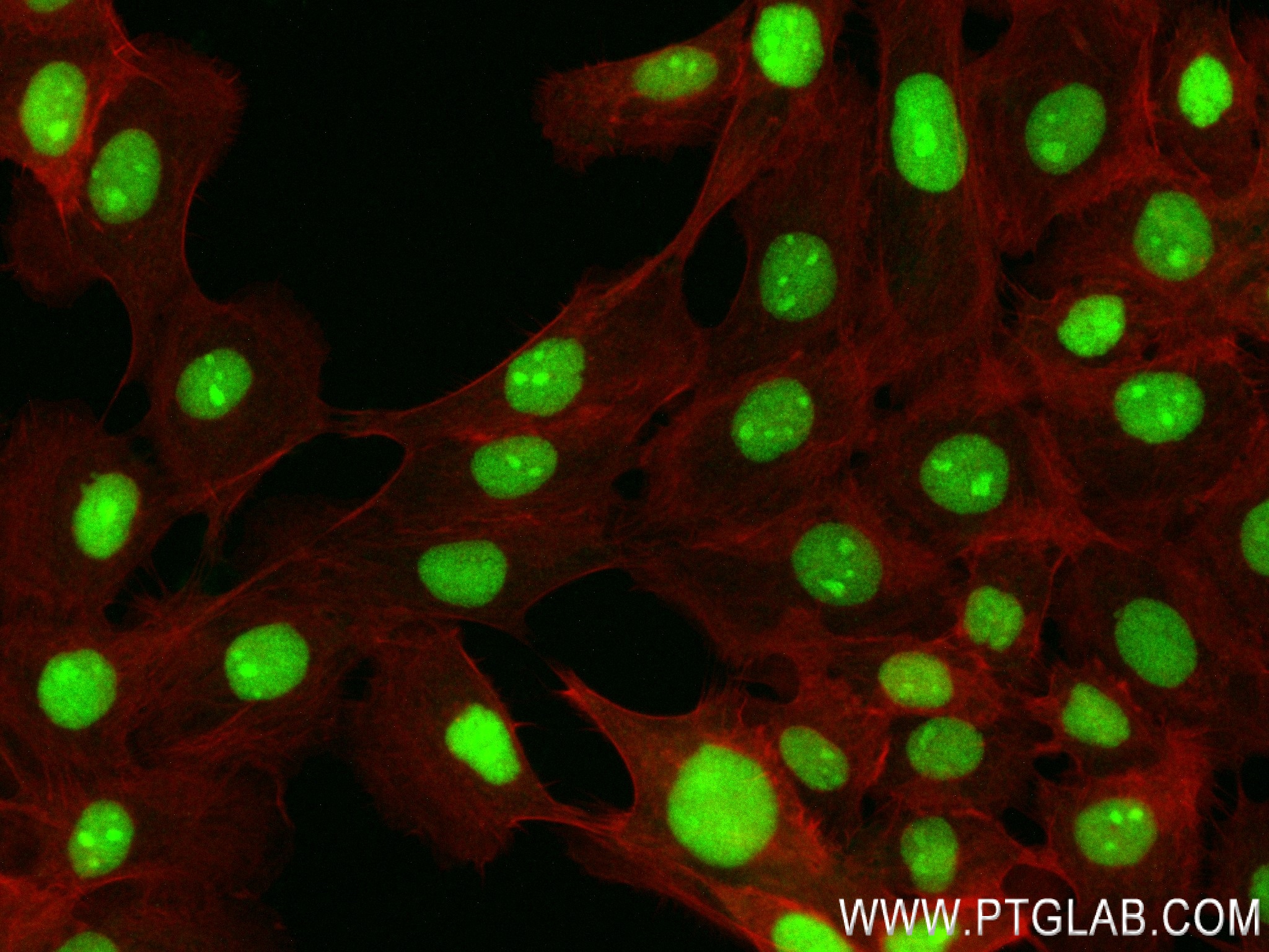 IF Staining of A431 using 83843-5-RR (same clone as 83843-5-PBS)