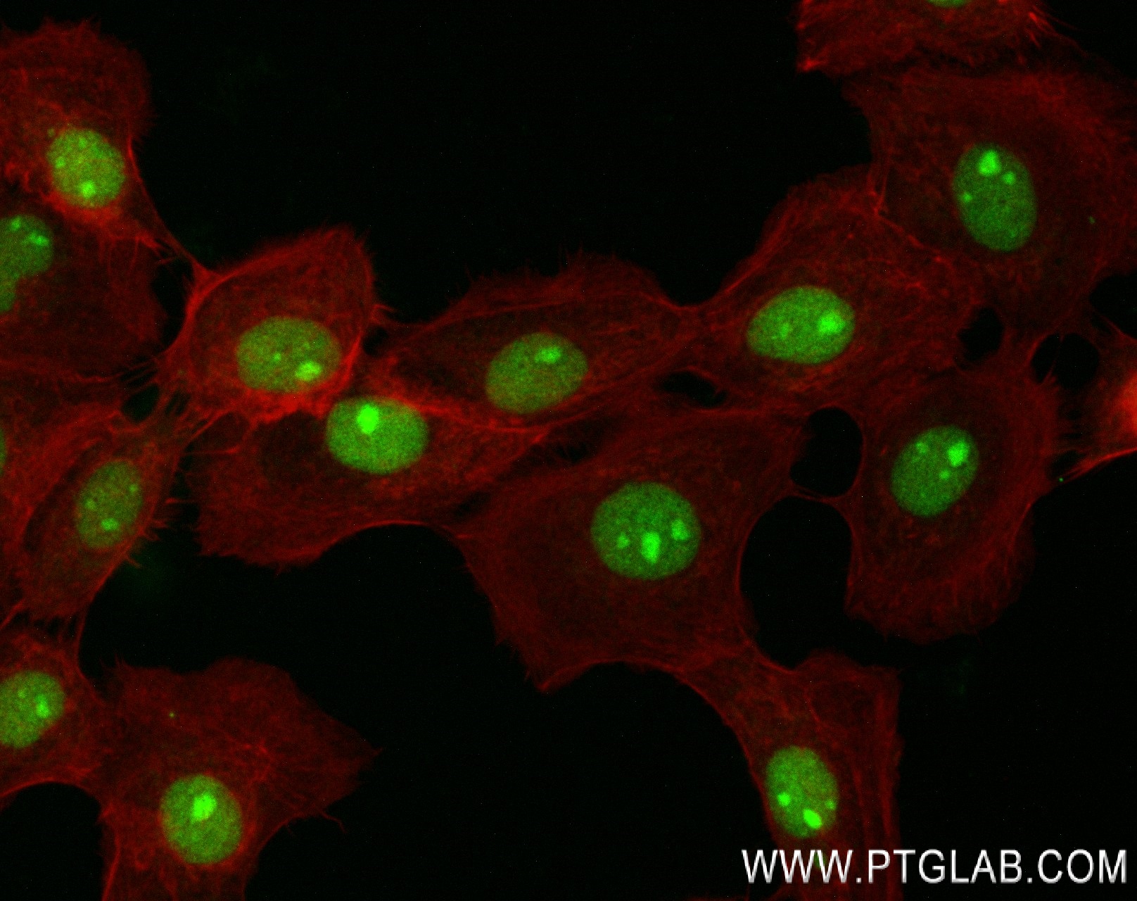 IF Staining of A431 using 83843-6-RR (same clone as 83843-6-PBS)