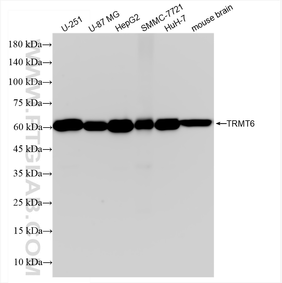 WB analysis using 83843-6-RR (same clone as 83843-6-PBS)