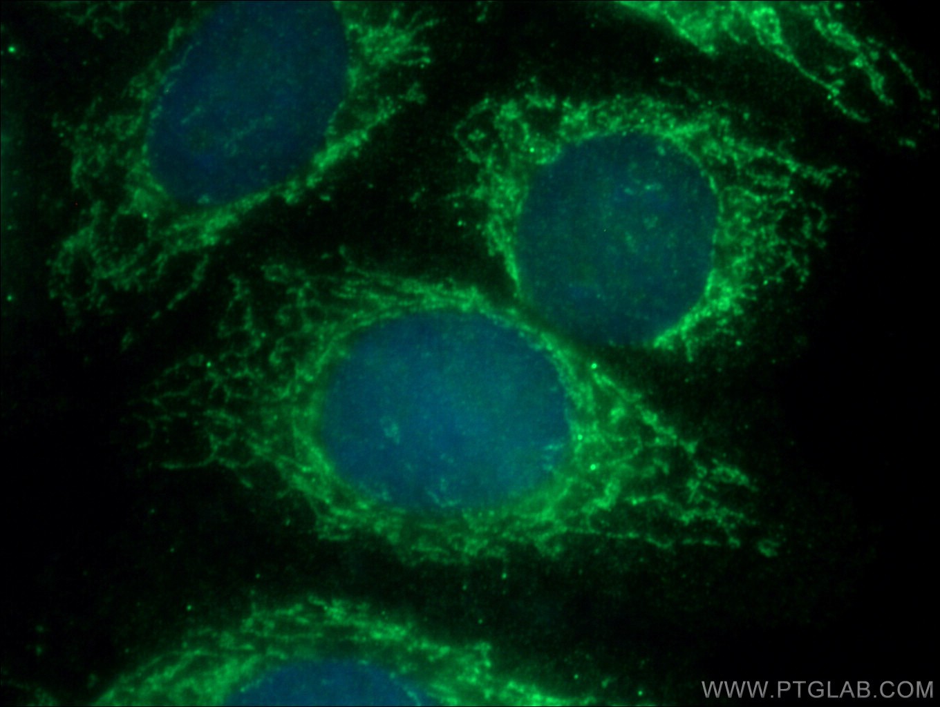 IF Staining of HepG2 using 25376-1-AP