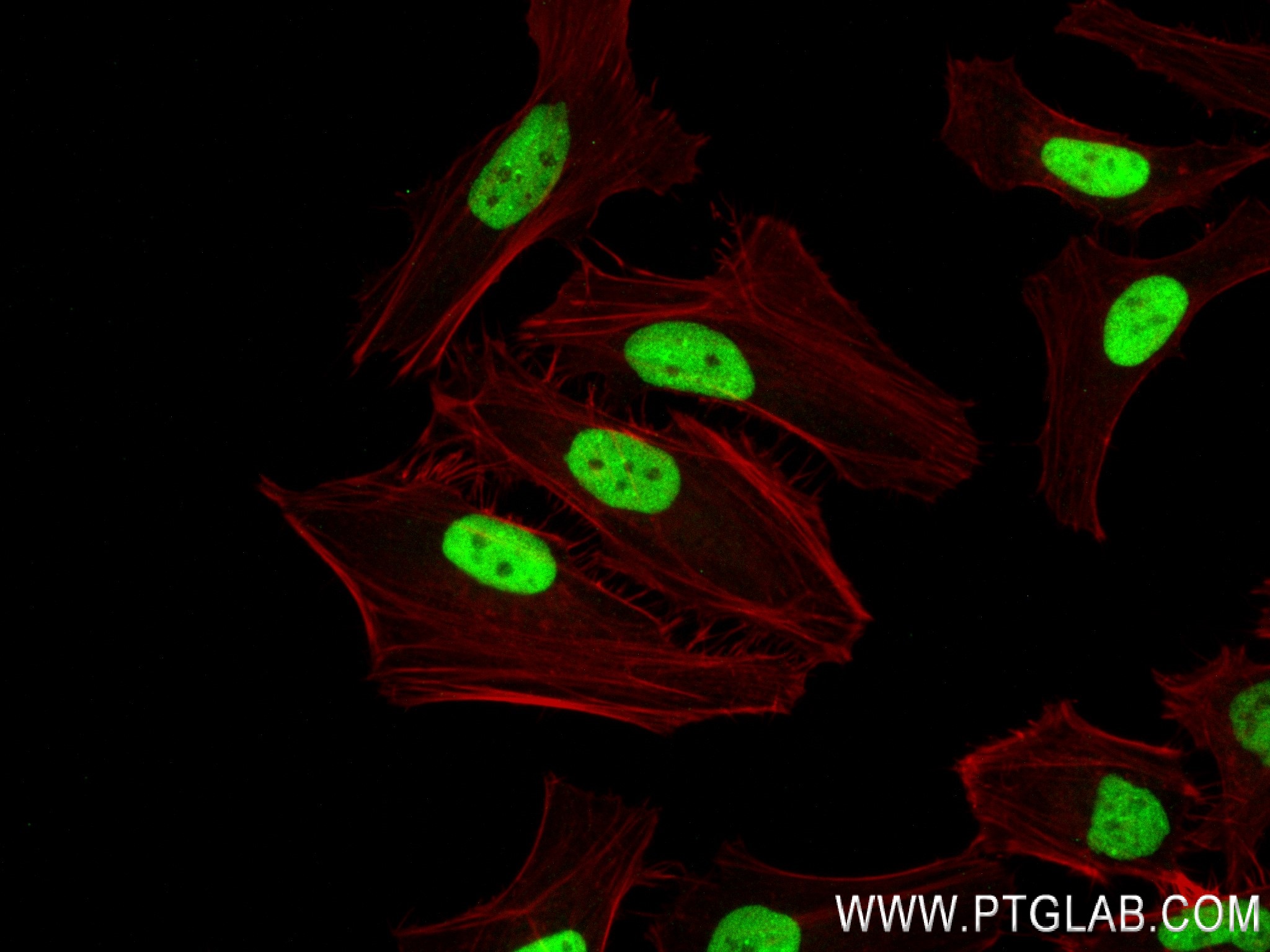 IF Staining of HeLa using 83410-4-RR (same clone as 83410-4-PBS)