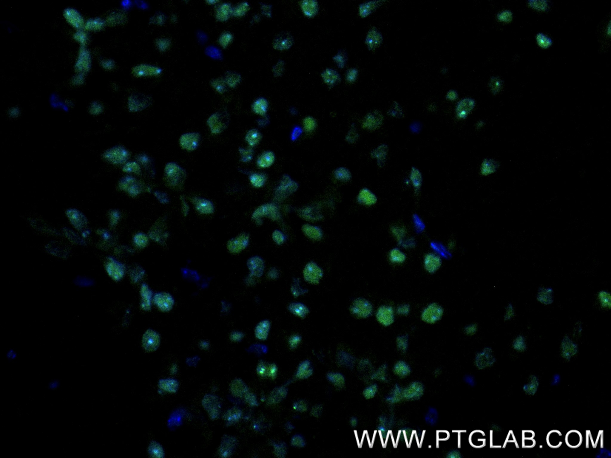 IF Staining of mouse brain using 83410-4-RR