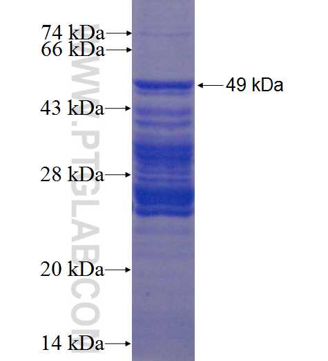 TRNP1 fusion protein Ag22504 SDS-PAGE