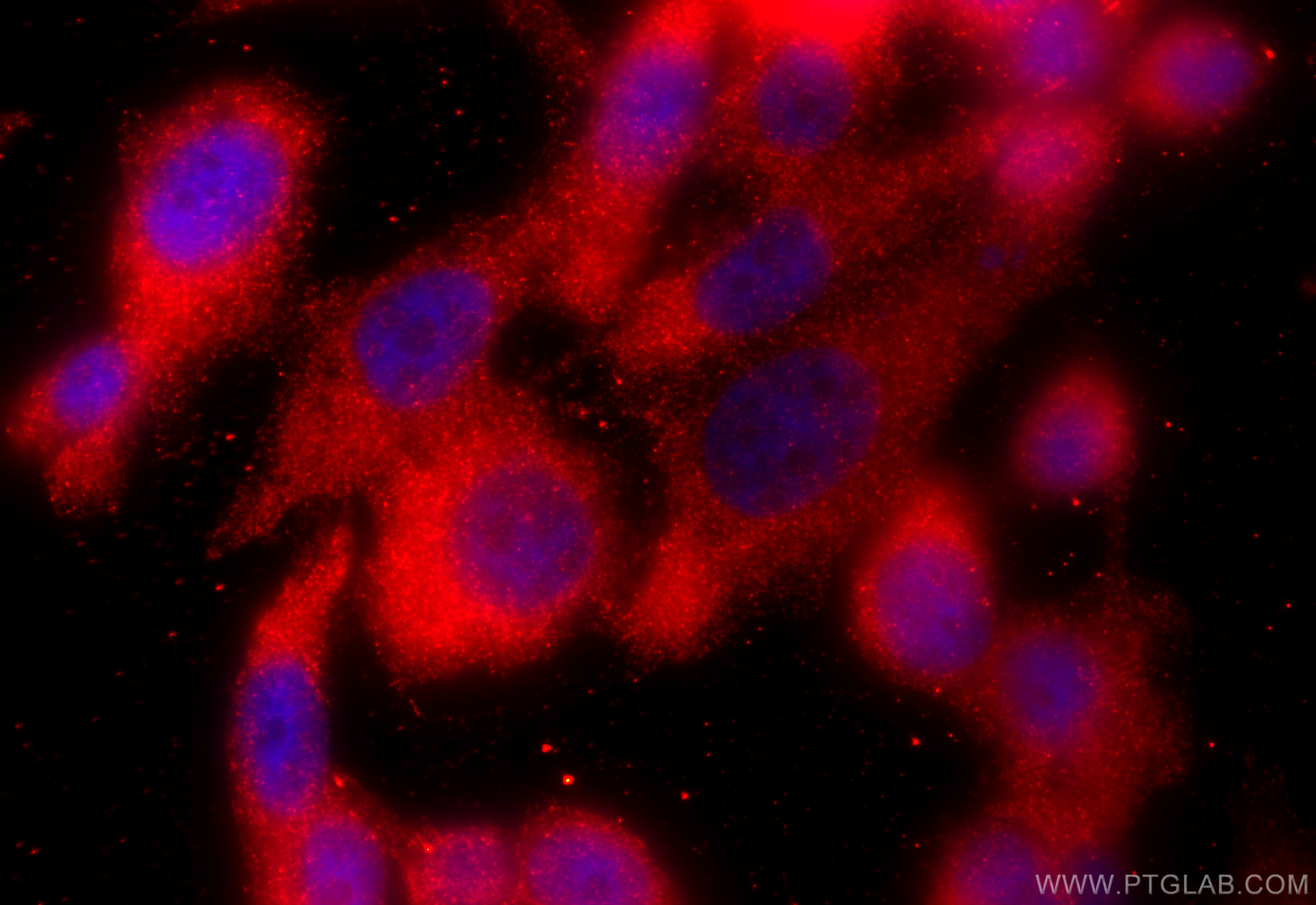 IF Staining of PC-3 using 12718-1-AP