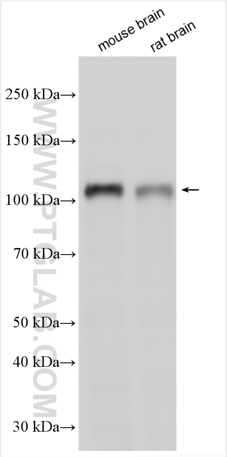 TRPC1