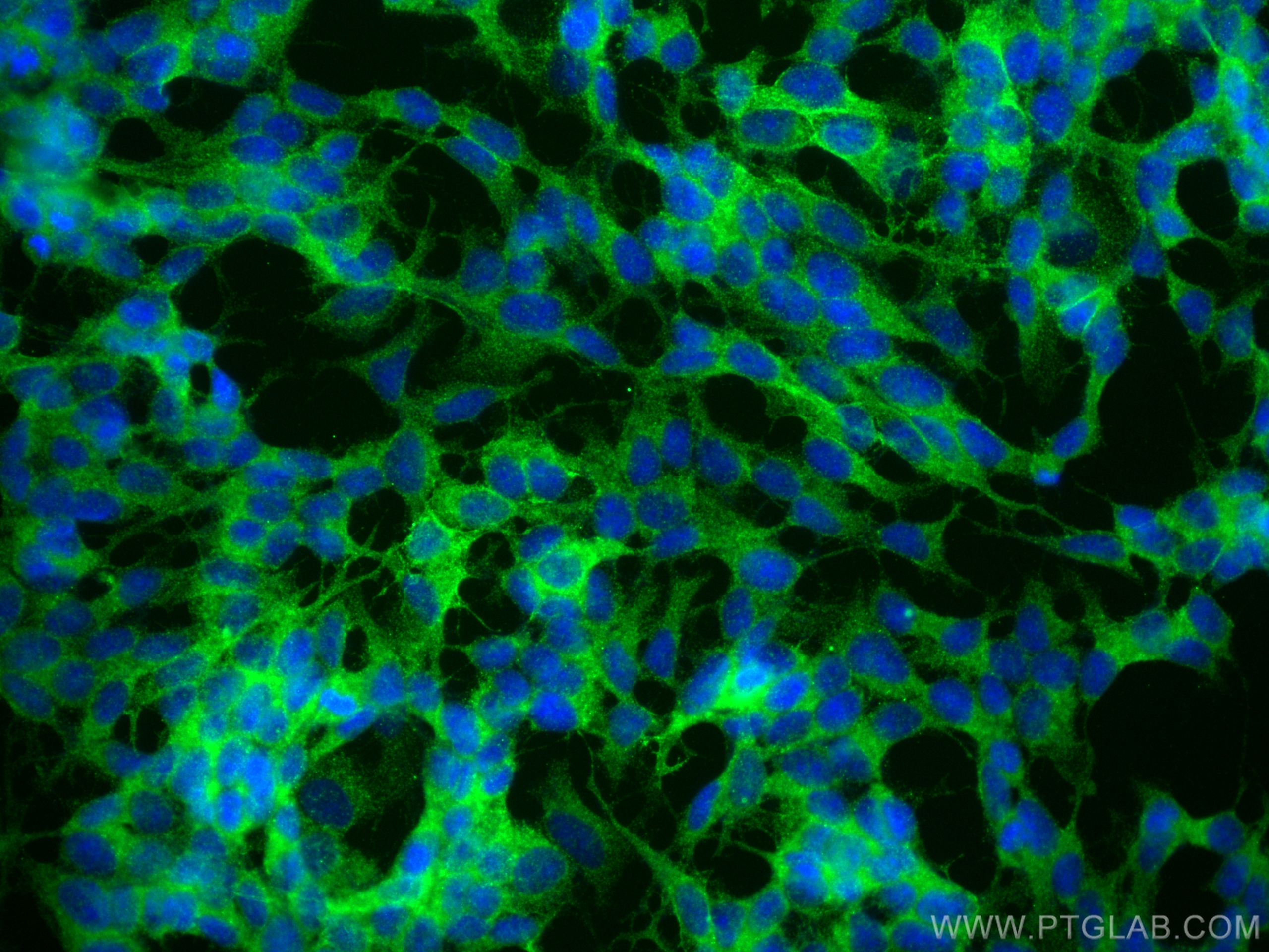 IF Staining of SH-SY5Y using 25890-1-AP