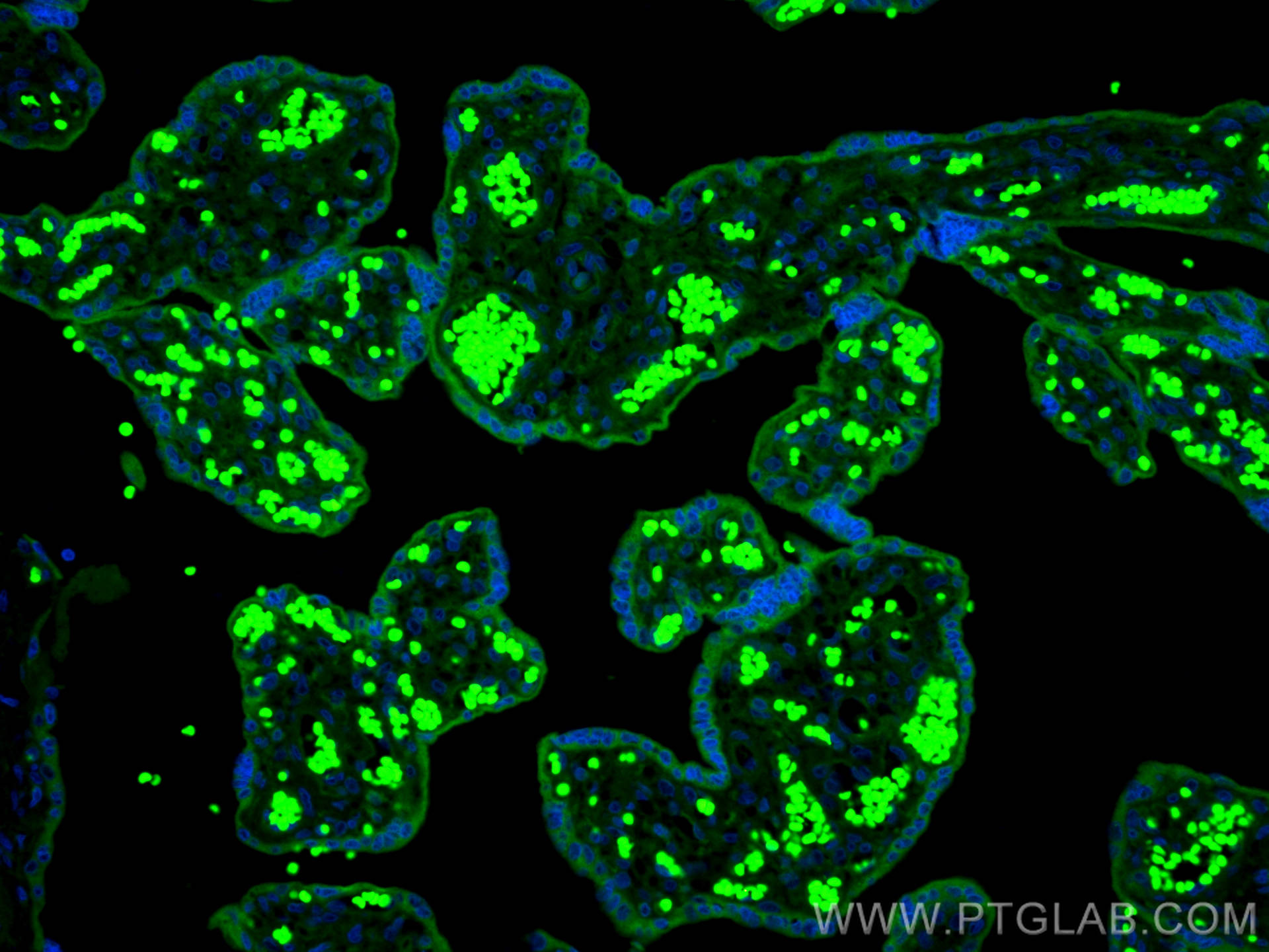 IF Staining of human placenta using CL488-18236