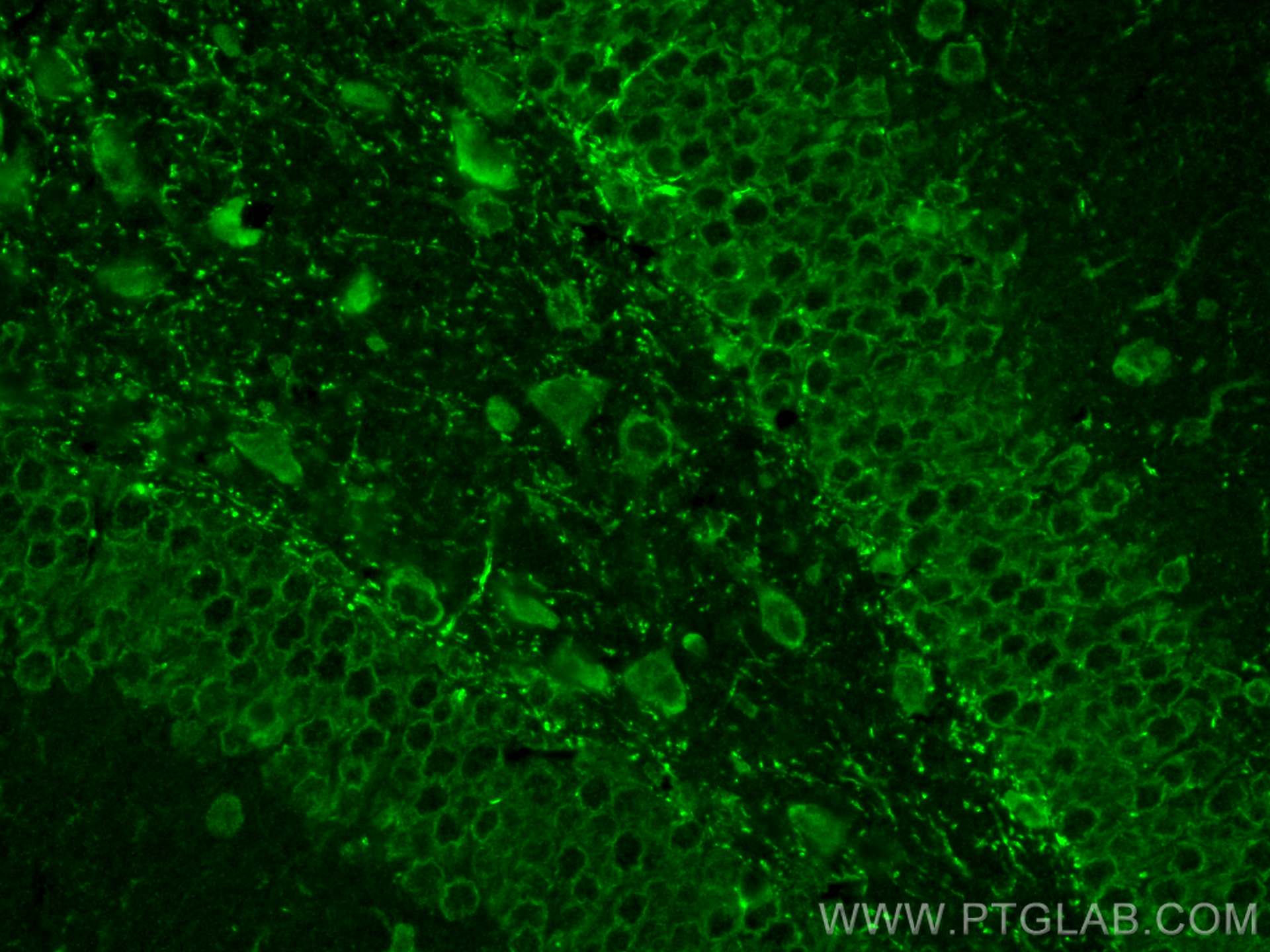 IF Staining of mouse brain using 21842-1-AP