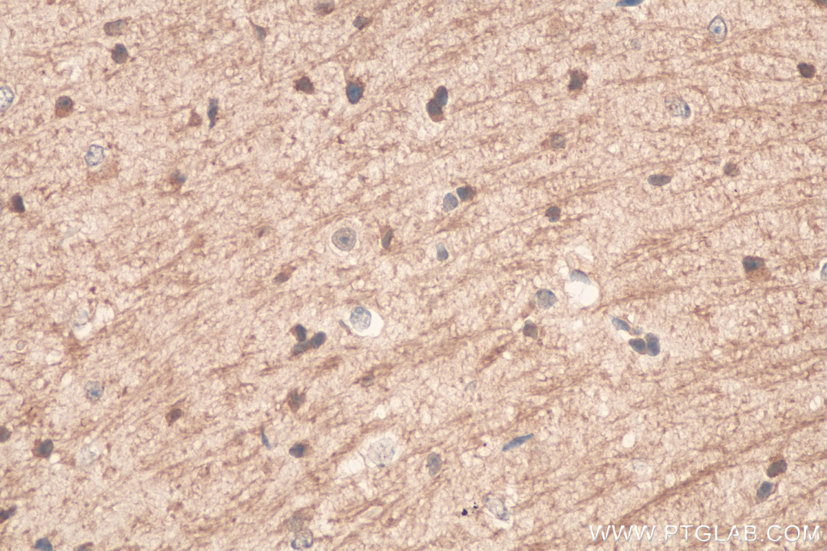 IHC staining of mouse brain using 21842-1-AP