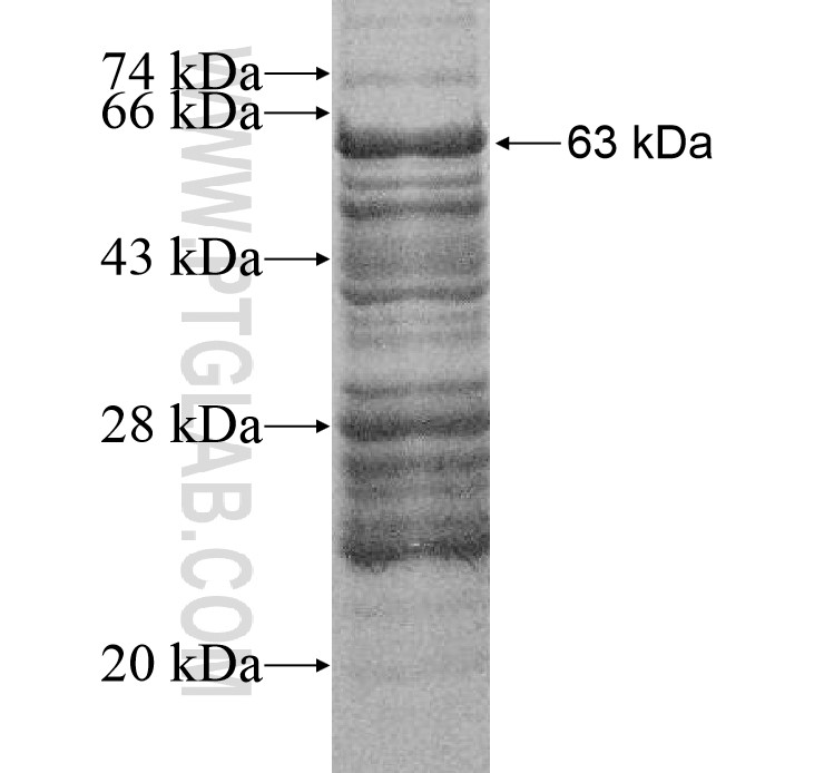 TRPM2 fusion protein Ag16522 SDS-PAGE