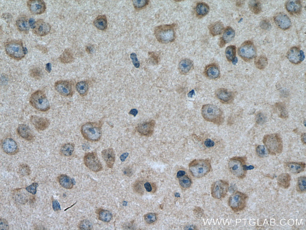 IHC staining of mouse brain using 21985-1-AP