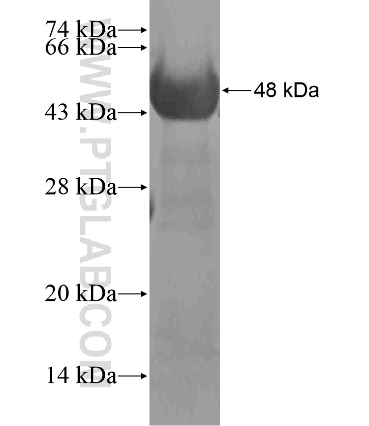 TRPM4 fusion protein Ag17687 SDS-PAGE