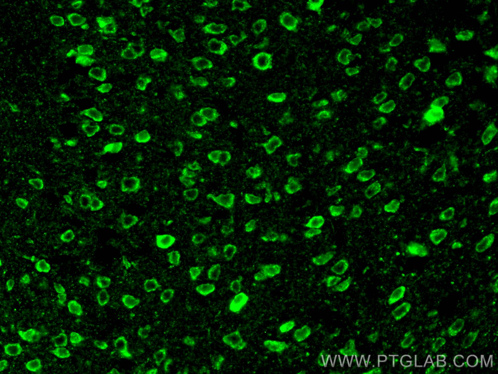 IF Staining of mouse brain using 22686-1-AP